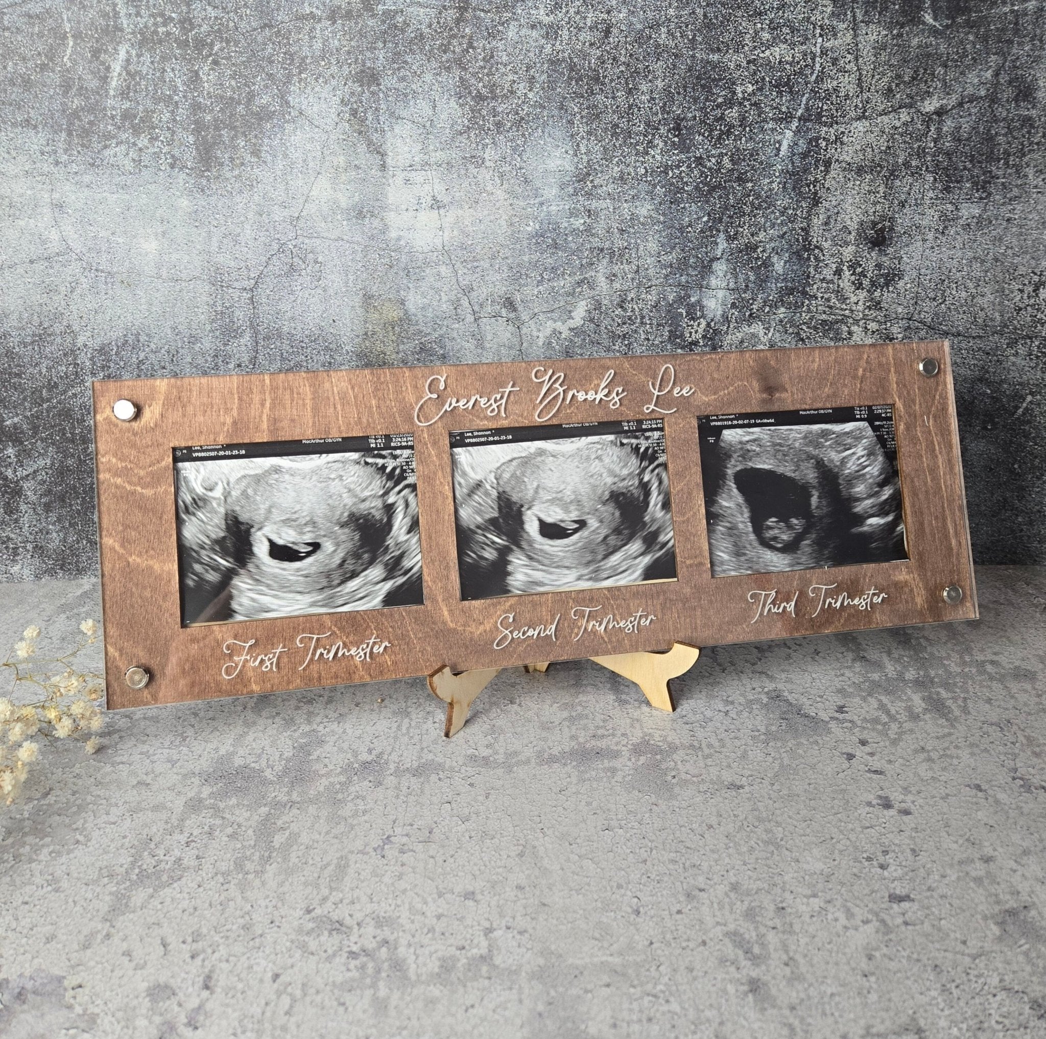Ultrasound Picture Frame 1st-3rd Trimester
