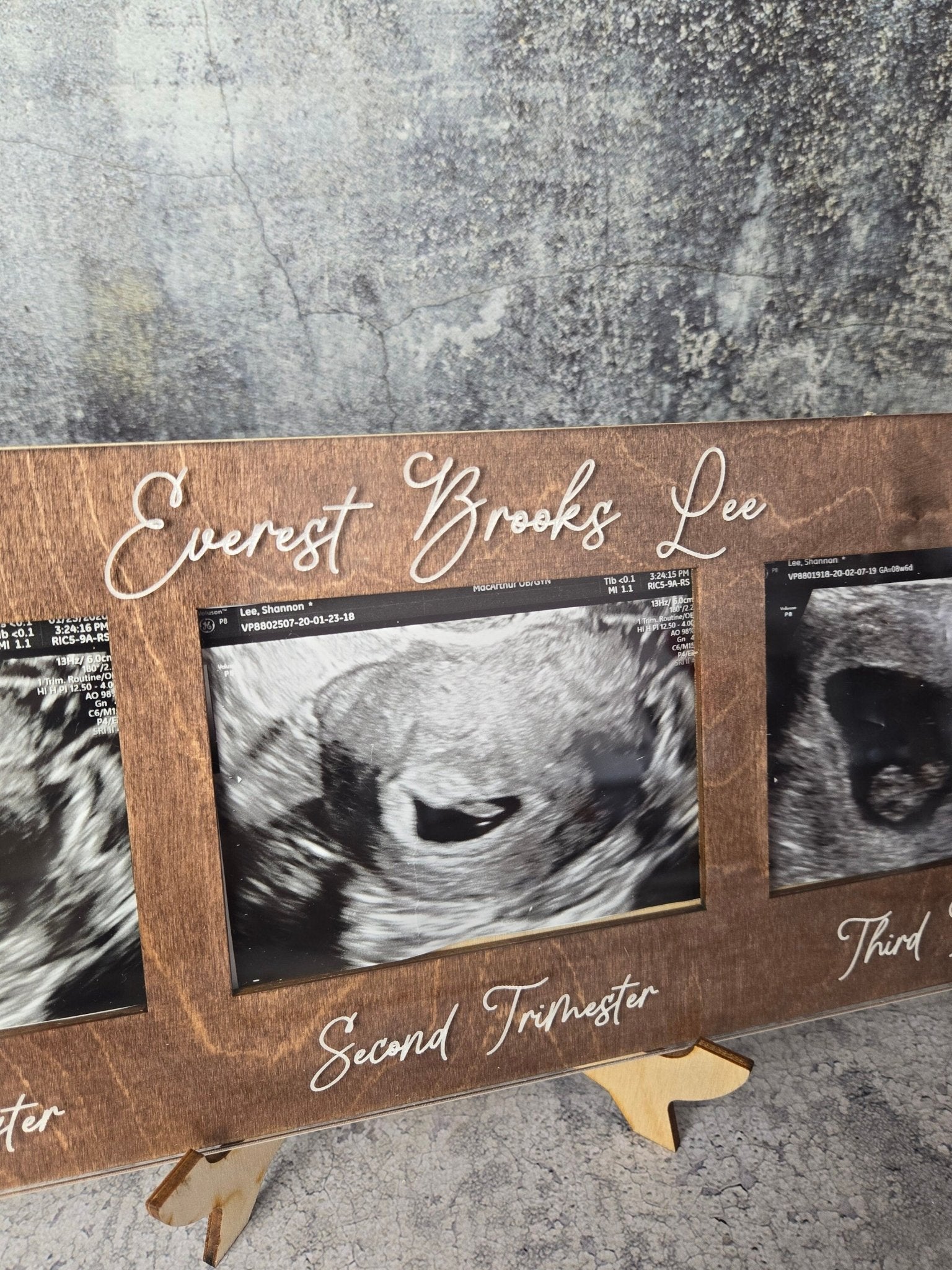 Ultrasound Picture Frame 1st-3rd Trimester