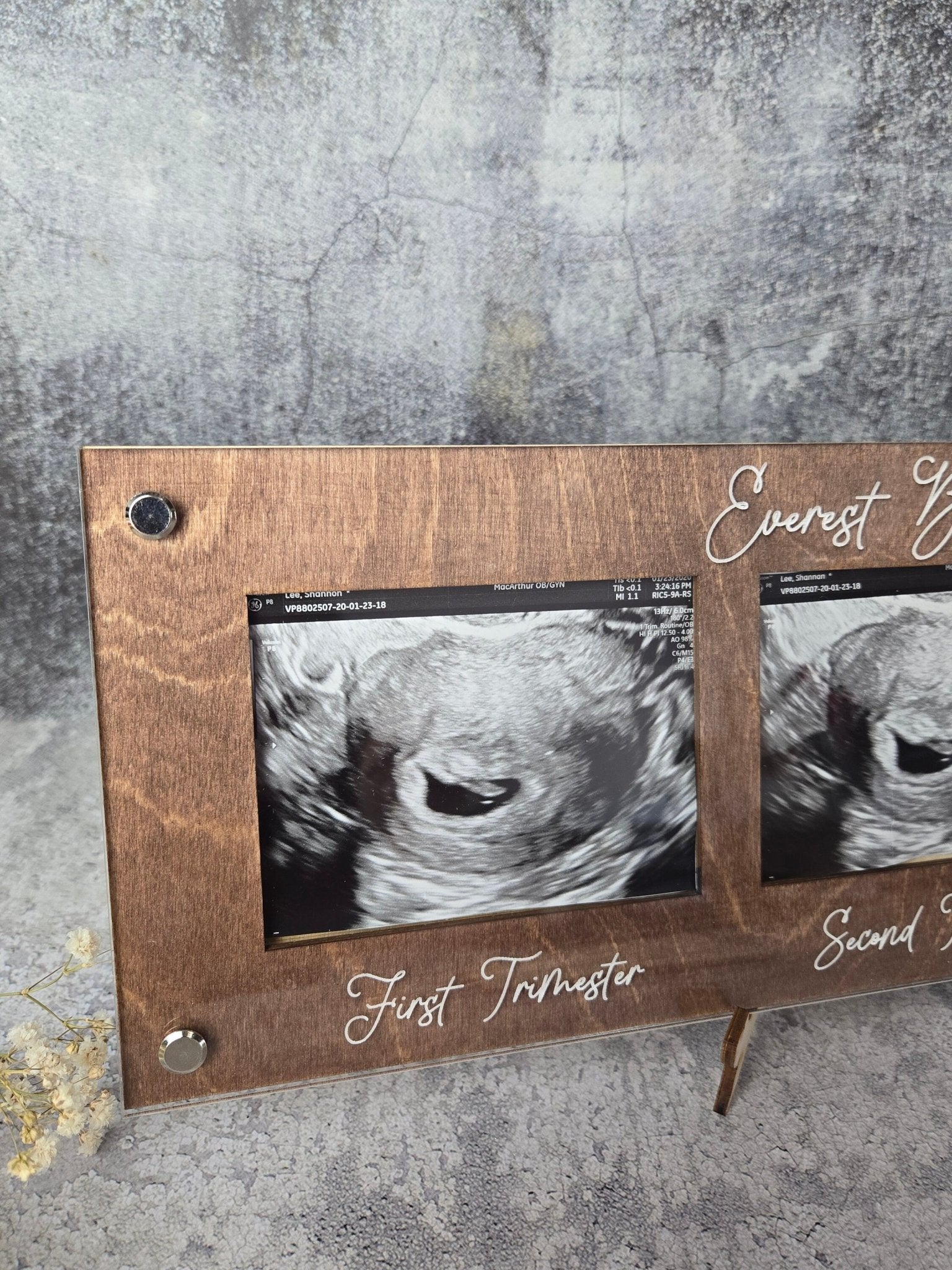 Ultrasound Picture Frame 1st-3rd Trimester