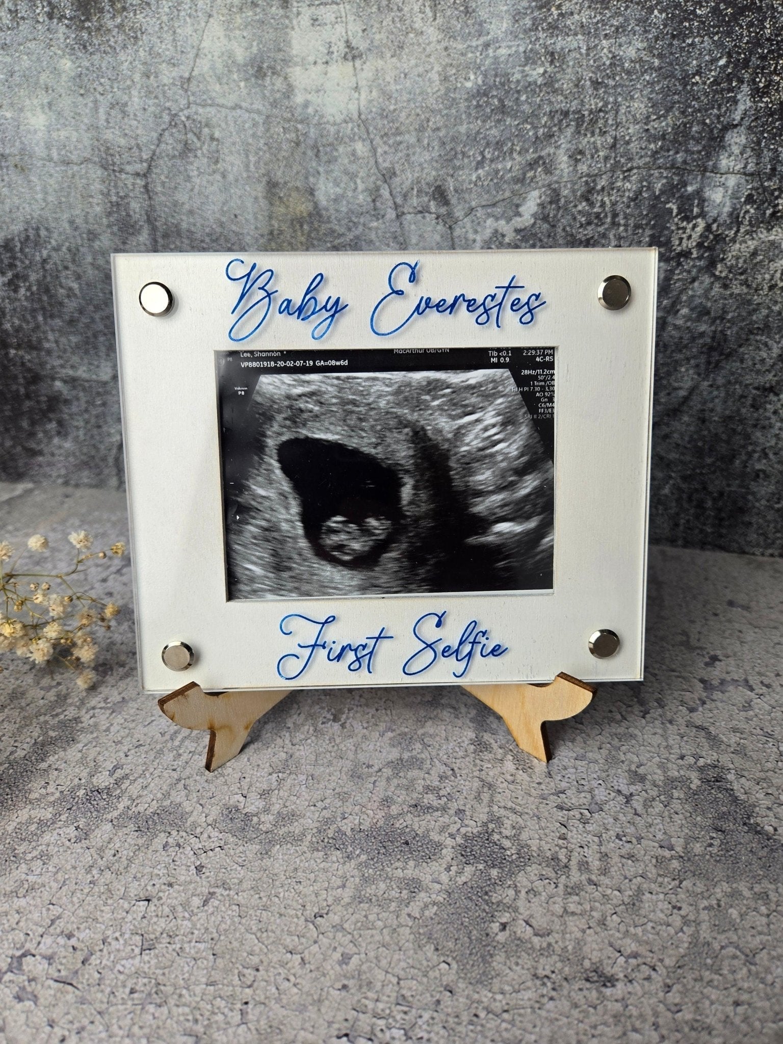 Ultrasound Picture Frame