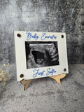 Ultrasound Picture Frame
