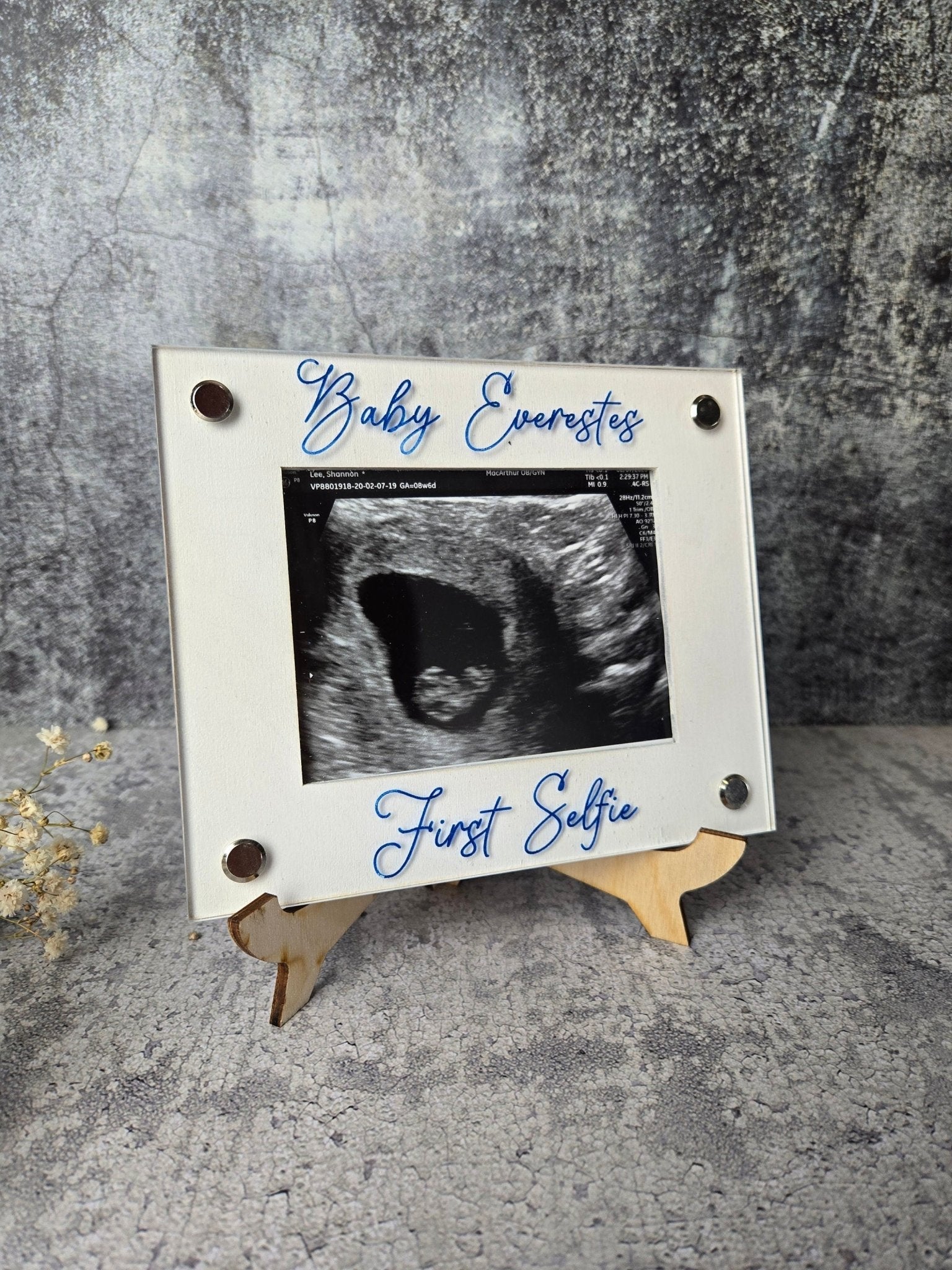 Ultrasound Picture Frame